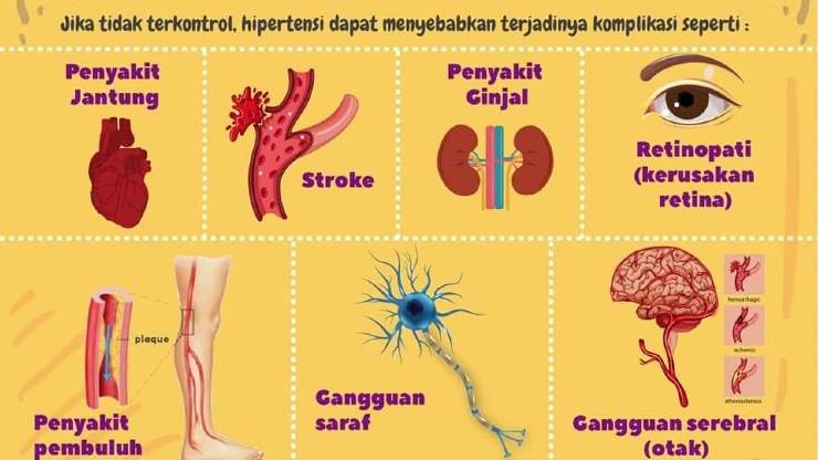 Hipertensi
