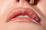 benjolan di bibir