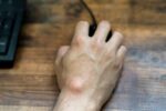 penyebab ganglion
